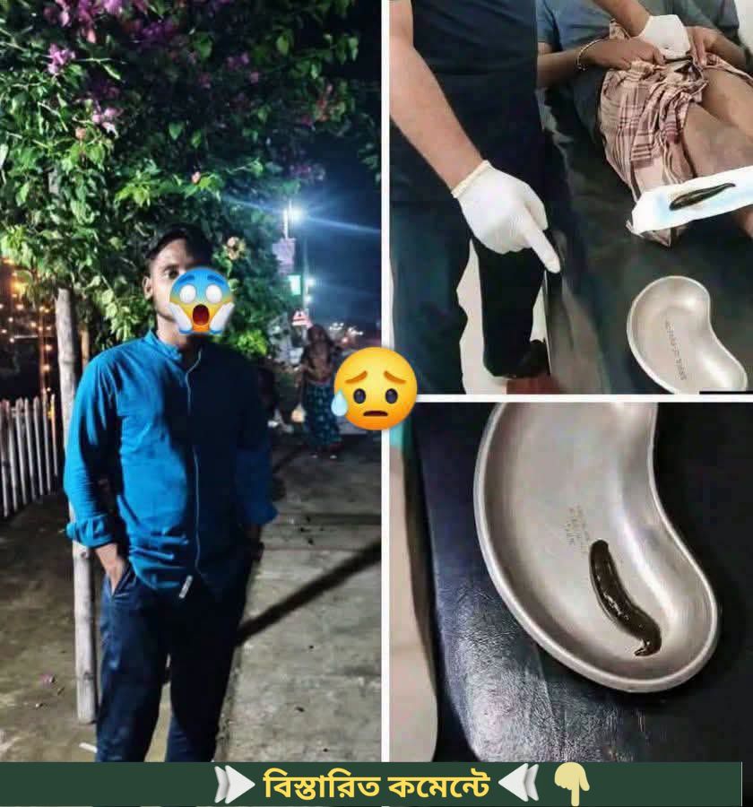 ২ জন ডাক্তার এবং ৫ জন নার্স-এর দীর্ঘ ৫৯ মিনিটের চেষ্টা…See more